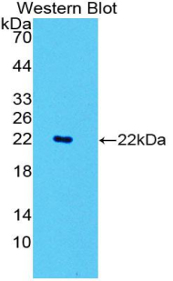 Polyclonal Antibody to Neutrophil Specific Antigen 1 (NB1)