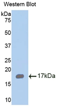 Polyclonal Antibody to Chemerin (CHEM)