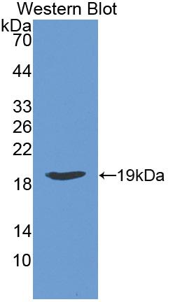 Polyclonal Antibody to Chemerin (CHEM)