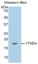 Polyclonal Antibody to Chemerin (CHEM)