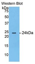 Polyclonal Antibody to Thymidine Phosphorylase (TP)