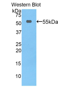 Polyclonal Antibody to Thymidine Phosphorylase (TP)