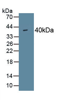 Polyclonal Antibody to Procollagen I N-Terminal Propeptide (PINP)