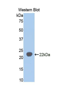 Polyclonal Antibody to Sialic Acid Binding Ig Like Lectin 5 (SIGLEC5)