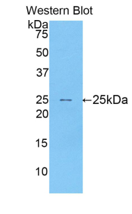 Polyclonal Antibody to Sialoadhesin (SN)