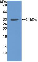 Polyclonal Antibody to Discoidin Domain Containing Receptor 2 (DDR2)