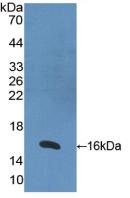 Polyclonal Antibody to Retinoic Acid Receptor Alpha (RARa)