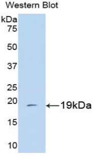 PAA979Hu01.jpg