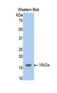 Polyclonal Antibody to Endoglin (ENG)