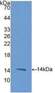 Polyclonal Antibody to Endoglin (ENG)