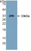 Polyclonal Antibody to Protein Tyrosine Phosphatase Receptor Type H (PTPRH)