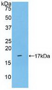 Polyclonal Antibody to Cluster Of Differentiation 161 (CD161)
