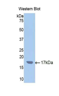 Polyclonal Antibody to Cytochrome P450 2E1 (CYP2E1)