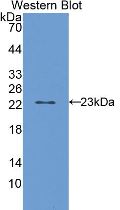 Polyclonal Antibody to Cytochrome P450 2E1 (CYP2E1)