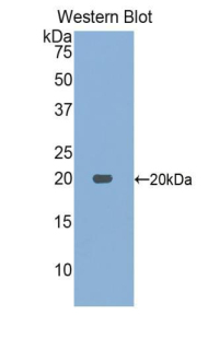 Polyclonal Antibody to Acid Phosphatase 1 (ACP1)