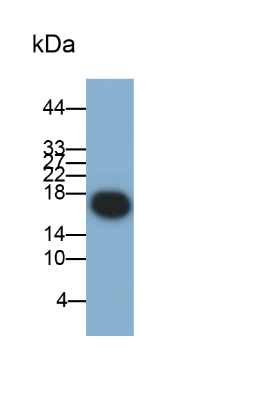 Polyclonal Antibody to Acid Phosphatase 1 (ACP1)