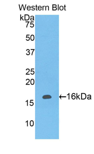 Polyclonal Antibody to Leukocyte Associated Immunoglobulin Like Receptor 2 (LAIR2)