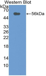 Polyclonal Antibody to Cluster Of Differentiation 320 (CD320)