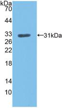 Polyclonal Antibody to Low Density Lipoprotein Receptor (LDLR)