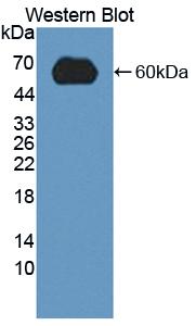 Polyclonal Antibody to Low Density Lipoprotein Receptor (LDLR)