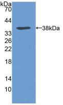 Polyclonal Antibody to Very Low Density Lipoprotein Receptor (VLDLR)