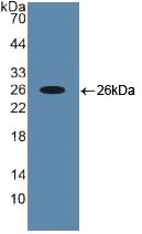 Polyclonal Antibody to Runt Related Transcription Factor 2 (RUNX2)