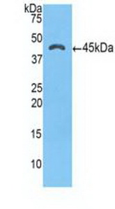 Polyclonal Antibody to Alpha-1-Antichymotrypsin (a1ACT)