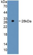 Polyclonal Antibody to Alpha-2-Macroglobulin (a2M)