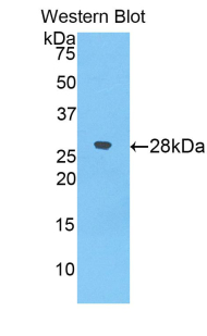 Polyclonal Antibody to Alpha-2-Macroglobulin (a2M)