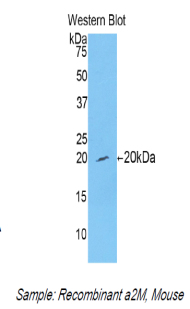 Polyclonal Antibody to Alpha-2-Macroglobulin (a2M)