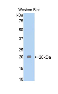 Polyclonal Antibody to Alpha-2-Macroglobulin (a2M)