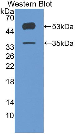 Polyclonal Antibody to Angiopoietin Like Protein 4 (ANGPTL4)