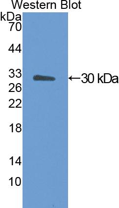 Polyclonal Antibody to Angiopoietin Like Protein 4 (ANGPTL4)