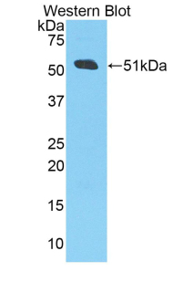 Polyclonal Antibody to Amyloid Precursor Protein (APP)