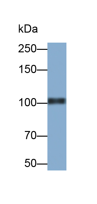 Polyclonal Antibody to Amyloid Precursor Protein (APP)