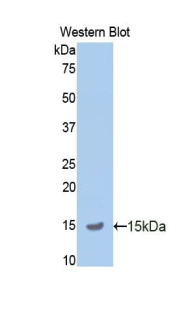 Polyclonal Antibody to Amyloid Precursor Protein (APP)