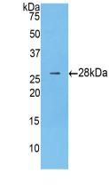 Polyclonal Antibody to Beta Catenin (β-catenin)