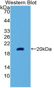 Polyclonal Antibody to Neuromedin U (NMU)