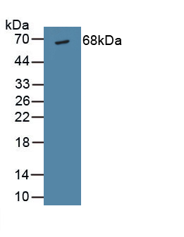 Polyclonal Antibody to Albumin (ALB)