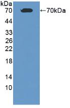 Polyclonal Antibody to Albumin (ALB)