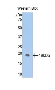 Polyclonal Antibody to Glypican 1 (GPC1)