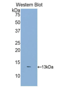 Polyclonal Antibody to Dickkopf Related Protein 2 (DKK2)