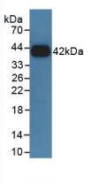 Polyclonal Antibody to Growth Hormone Receptor (GHR)