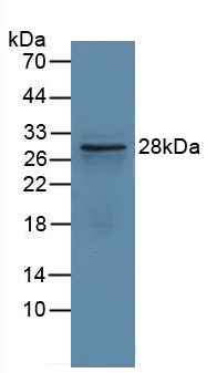 Polyclonal Antibody to Glutamate Cysteine Ligase, Modifier Subunit (GCLM)