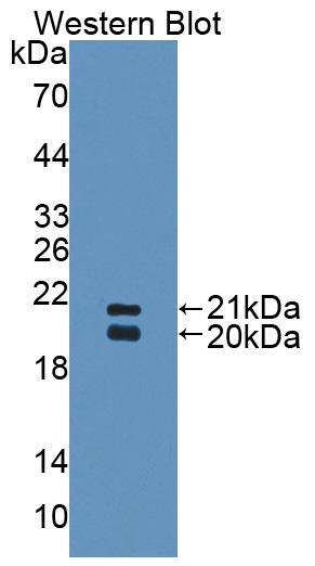 Polyclonal Antibody to Surfactant Associated Protein D (SPD)