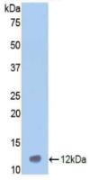 Polyclonal Antibody to Vitronectin (VTN)