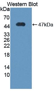 Polyclonal Antibody to Vitronectin (VTN)