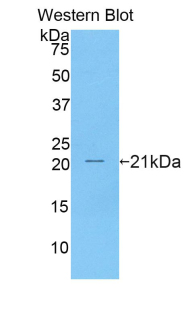 Polyclonal Antibody to Tumor Necrosis Factor Receptor Superfamily, Member 7 (TNFRSF7)