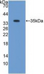 Polyclonal Antibody to Protein Kinase C Beta 1 (PKCb1)