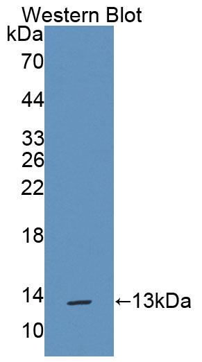 Polyclonal Antibody to Trefoil Factor 1 (TFF1)